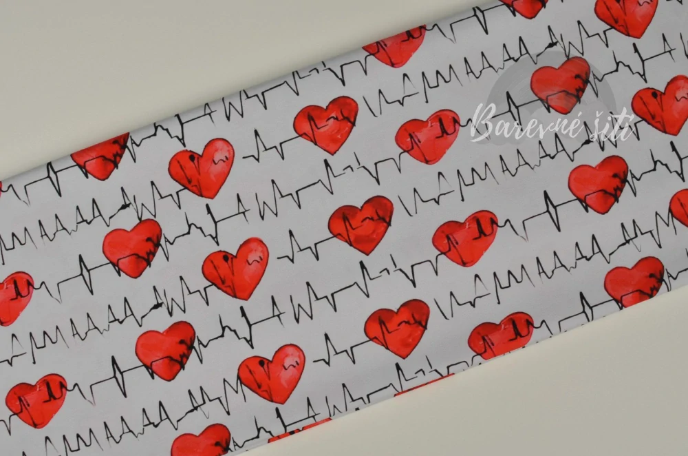 Úplet, EKG srdíčka (E)
