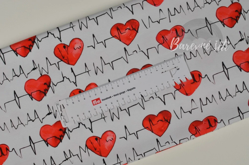 Úplet, EKG srdíčka (E)